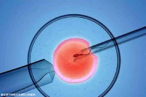 关于私人高龄代怀助孕服务哪家好